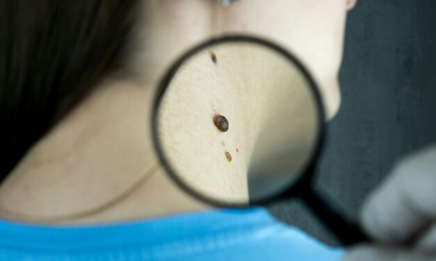 Dry Skin Bothering You? See a Dermatologist in Laval
